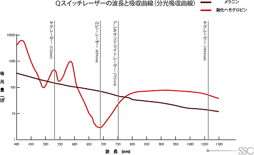 Qスイッチレーザーの波長と吸収曲線（分光吸収曲線）