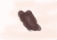 赤ちゃん・子どもの黒あざ