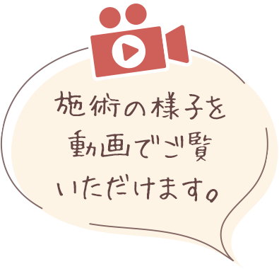 治療の様子のイメージ動画